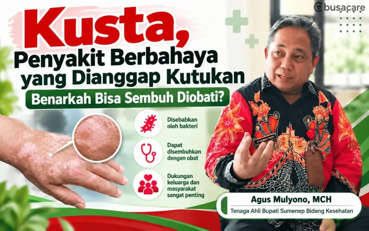 Kusta, Penyakit Berbahaya yang Dianggap Kutukan : Benarkah Bisa Sembuh Diobati?